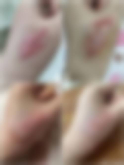 总结与预约建议