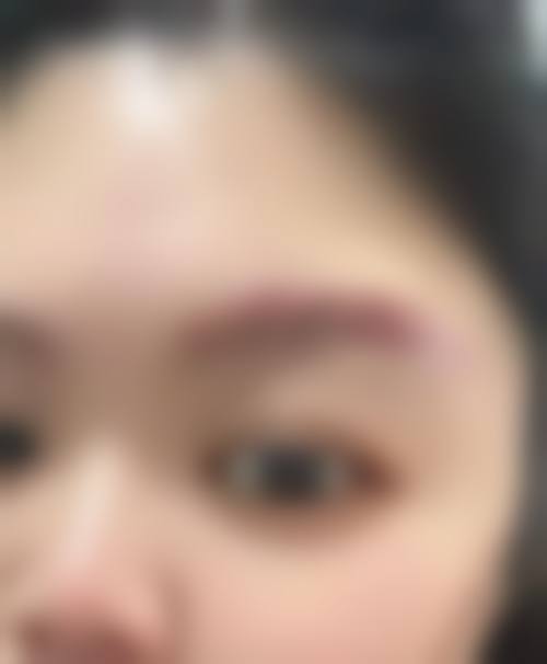 擅长项目详解郑州中平吉凯医疗美容门诊部朱珊
