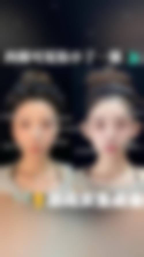 南昌佳美丽境医疗美容诊所患者口碑评价