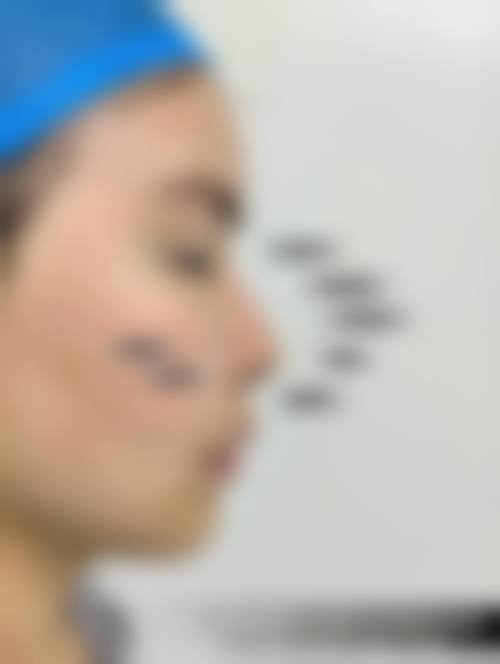 郑州聚美医疗整形美容核心优势