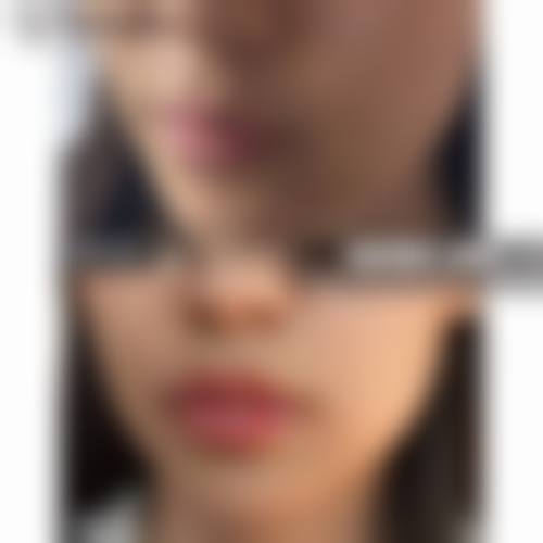 廿日市美容皮肤科是正规的吗?