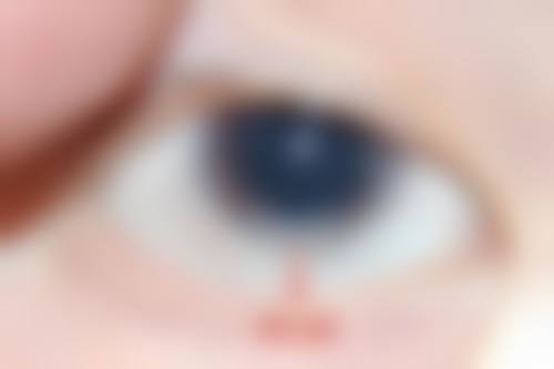 临床实例分享:真实疗效见证