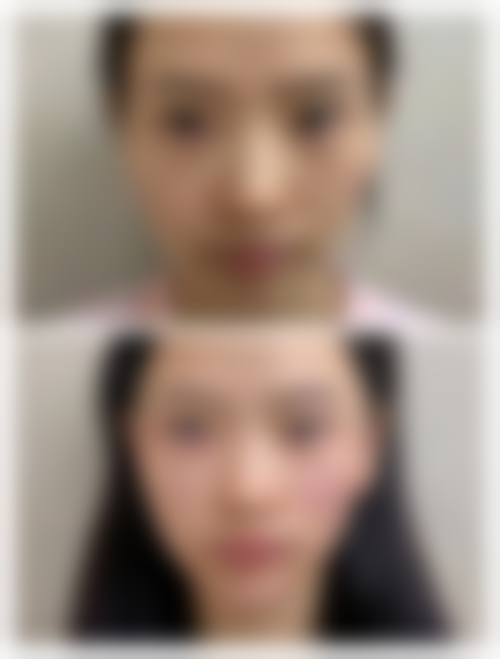 FAQ:石家庄壹零壹华擎医疗美容医院唐丽金医生常见问题解答