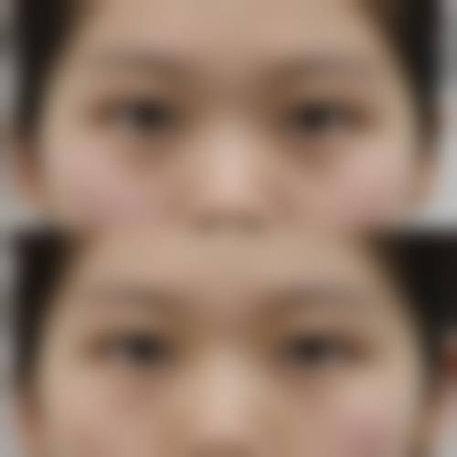 诊疗特色总结:石家庄壹零壹华擎医疗美容医院唐丽金医生如何服务?