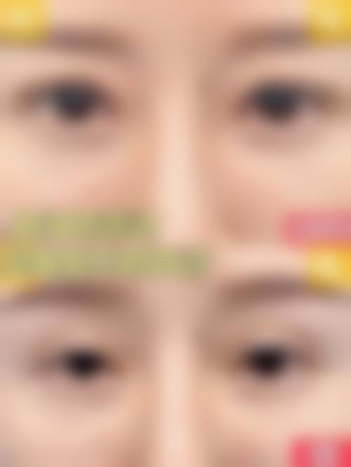临床实例分享：平煤神马医疗集团总医院眼科王瑞华的真实反馈
