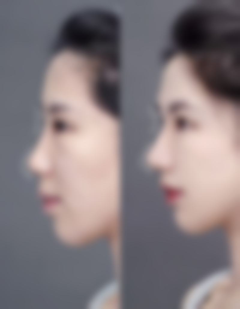 郑州聚美医疗整形美容特色项目