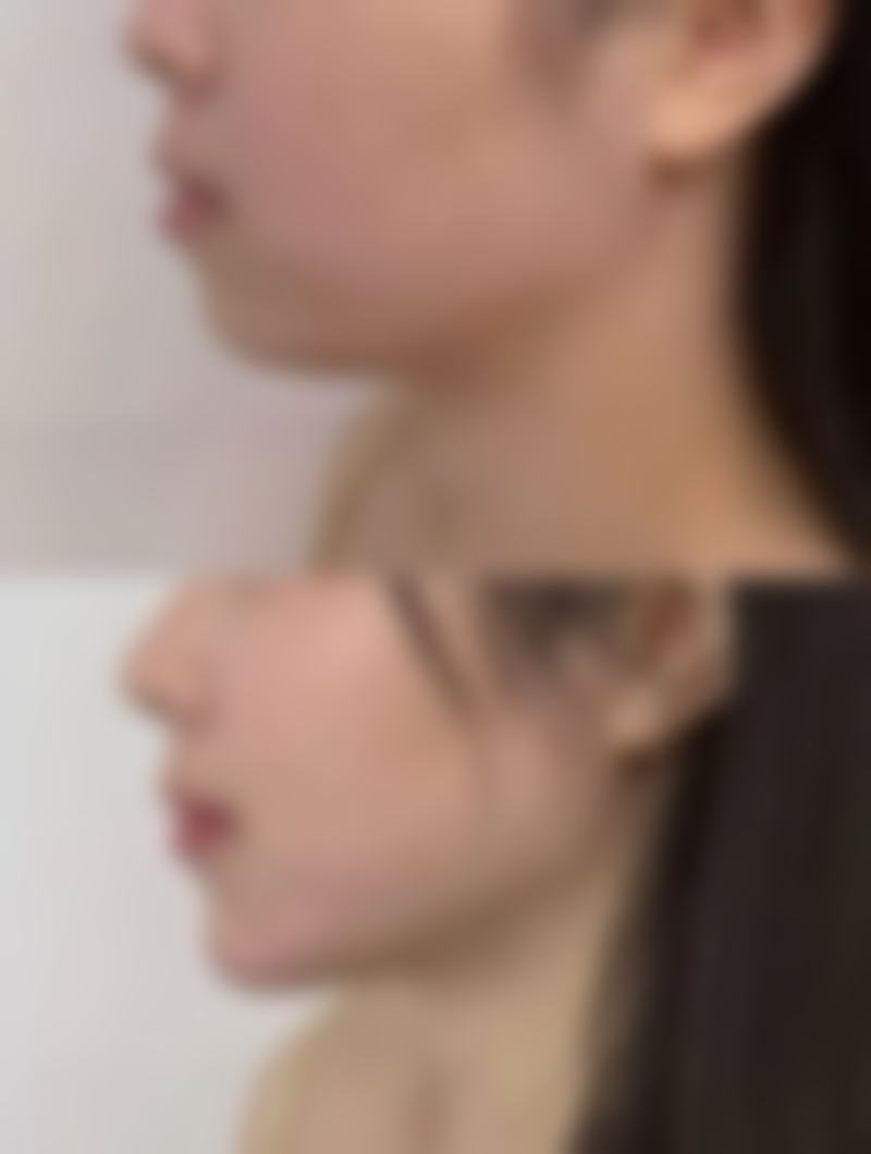擅长项目详解