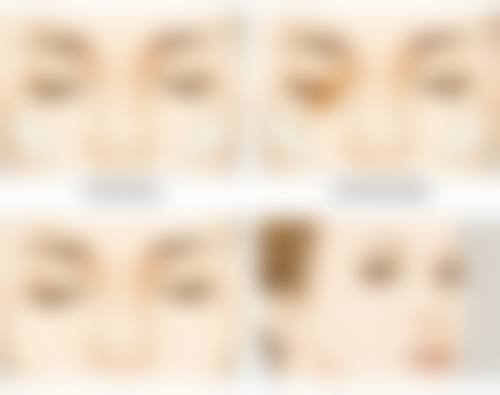 打瘦脸针有副作用吗?哪些反应是正常的?