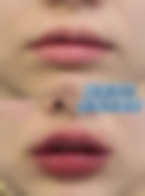 广州绮美医学美容门诊部是正规的吗？