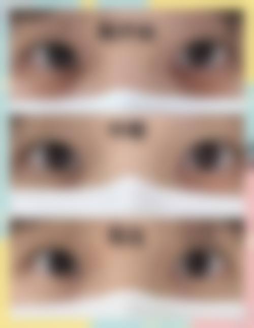 预约优惠活动:苏盛剑医生的专属补贴