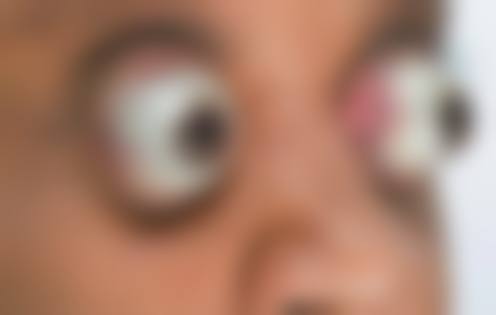 结尾预约号召:立即行动,守护双眼健康