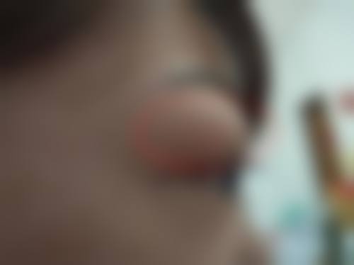 具有影响力资质与医生领衔,打造正规眼科诊疗平台