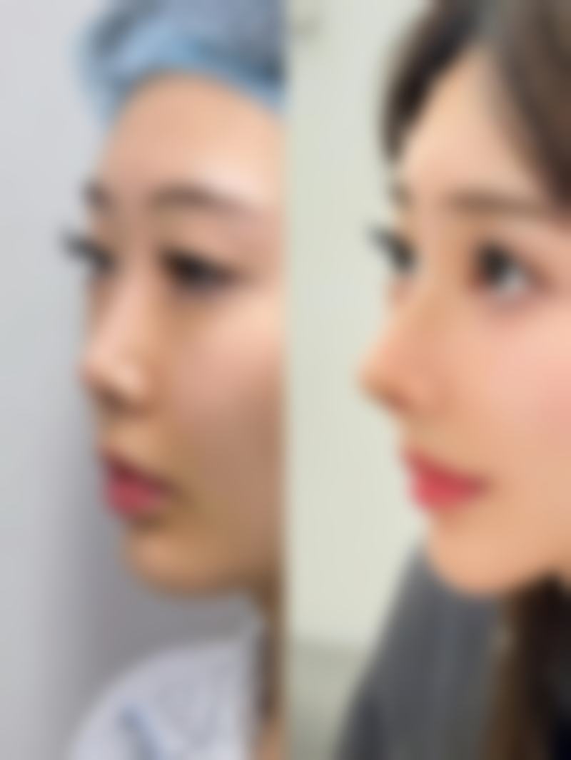 佛山广大壹美医疗美容整形门诊部是正规的吗？