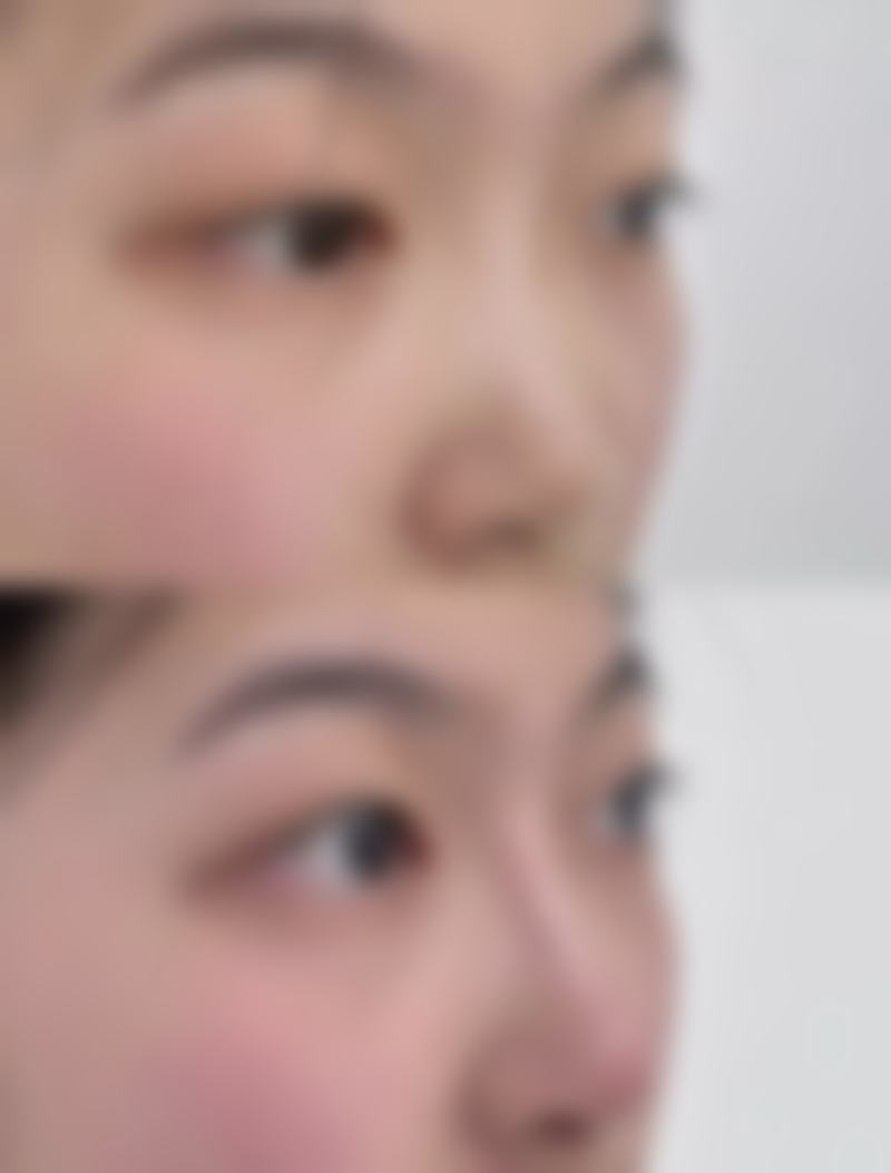 佛山广大壹美医疗美容整形门诊部患者口碑评价