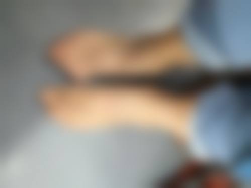 除皱针能起到提升成效吗?适合轻度松弛人群
