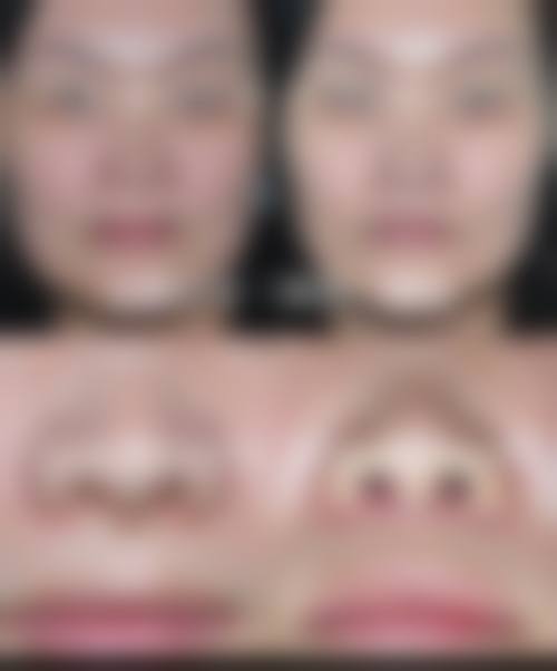 天津知妍医疗美容特色项目