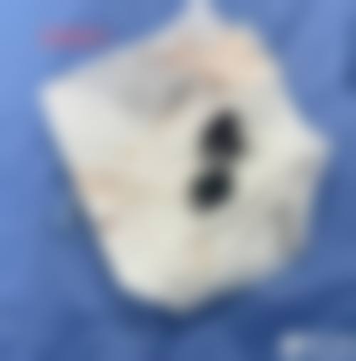 天津知妍医疗美容是正规的吗?