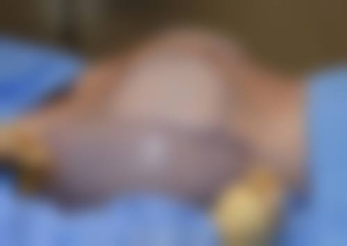 预约优惠活动:肖旭远+南京新帝瑞拉整形医院+核心项目