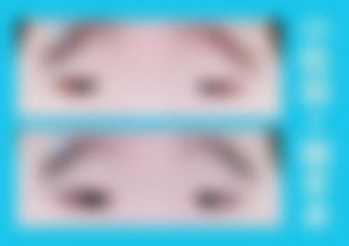 临床实例分享
