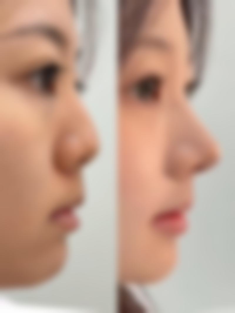 广州晨曦整形医院特色项目