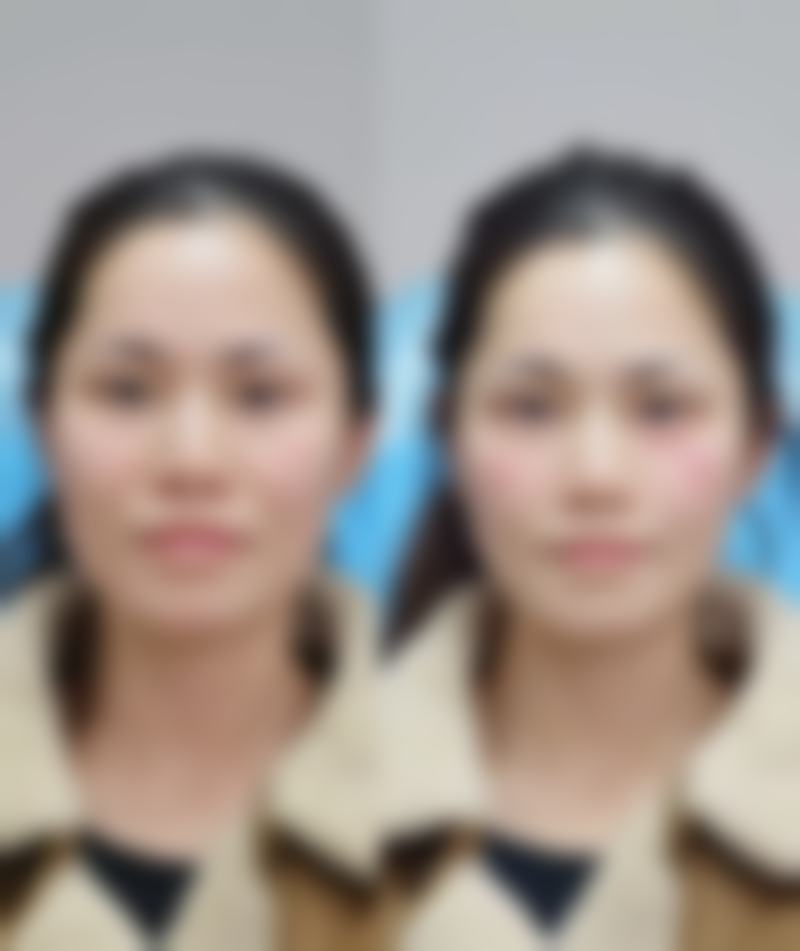 上海宏康医院美容皮肤科参考价格表