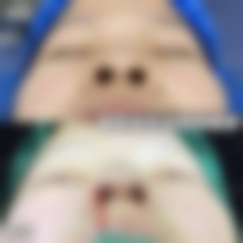 珠海九龙整形医院参考价格表