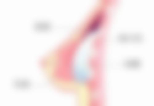种植的头发长出来为什么是弯曲的?