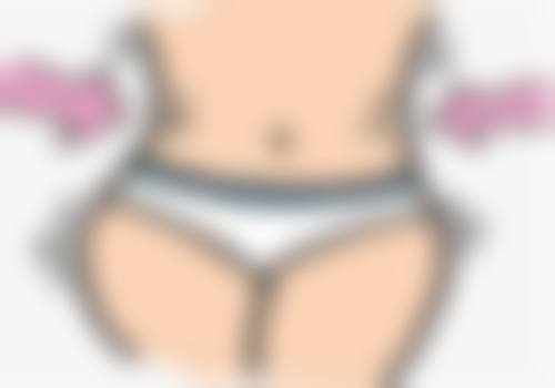 激光除疤成效如何?和除皱治疗的区别是什么