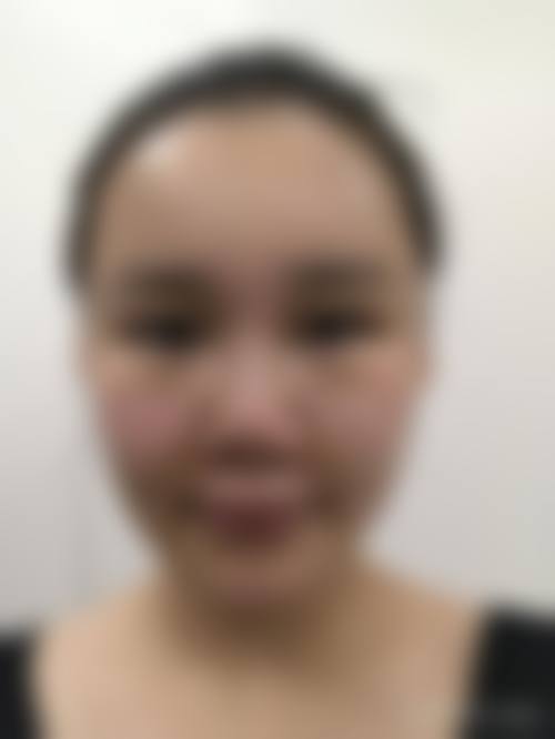 临床实例分享