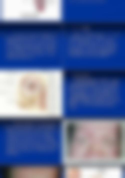 预约优惠活动德江县人民医院眼科