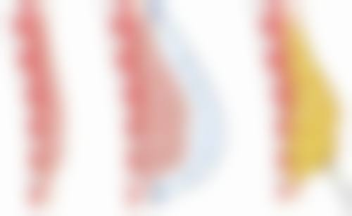 瘦脸针一次维持多久?打一次就能看到明确成效