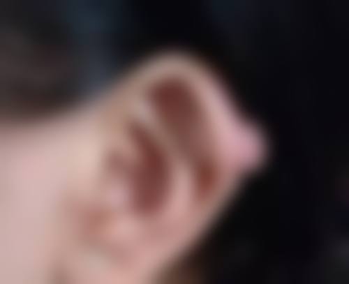 环切包皮手术后多久可同房?术后护理注意事项