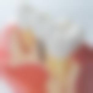 临床实例分享