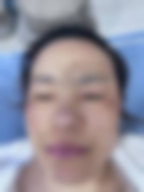 临床实例分享