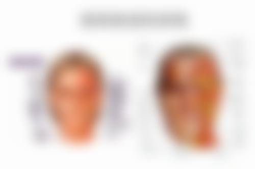 打瘦脸针能维持多久?影响时效的核心因素