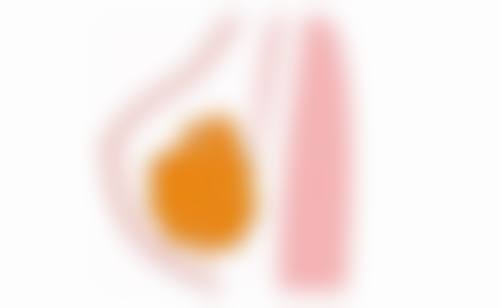 打了瘦脸针一年后突然出来小硬块?常见诱因及处理方式
