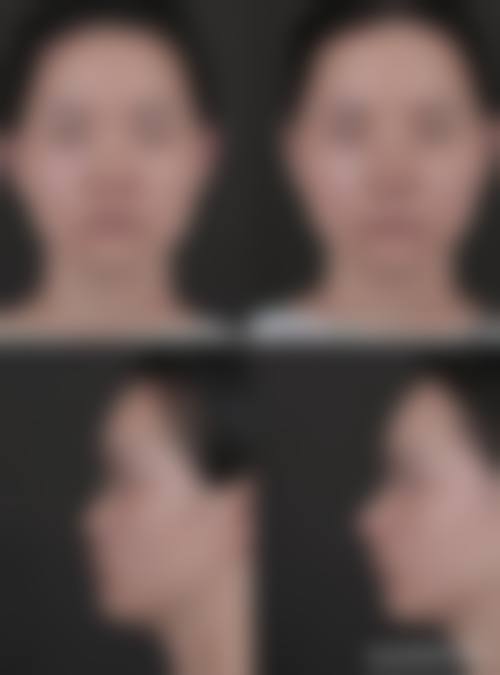擅长项目详解