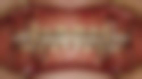 优惠活动详情与价格对比:透明收费减轻经济负担