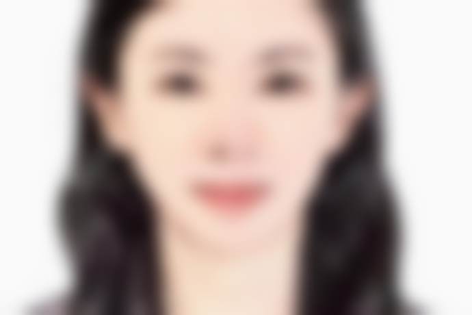韩国江南首延整形医院洪智铉医生技术优势靠谱吗