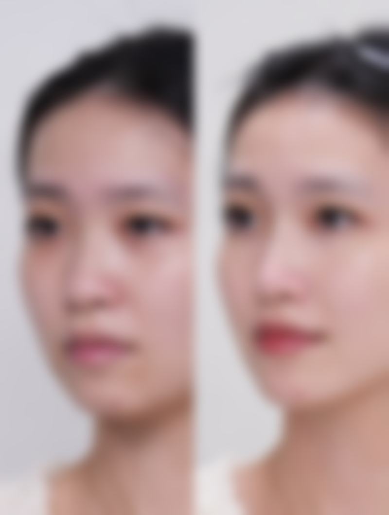 兴义市人民医院医学美容科核心优势